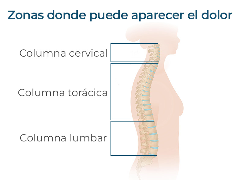 Cncrns_Cndtns-backpain-chart-392x294_@2x.jpg