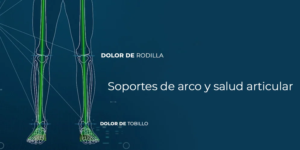 Soportes de arco y salud articular